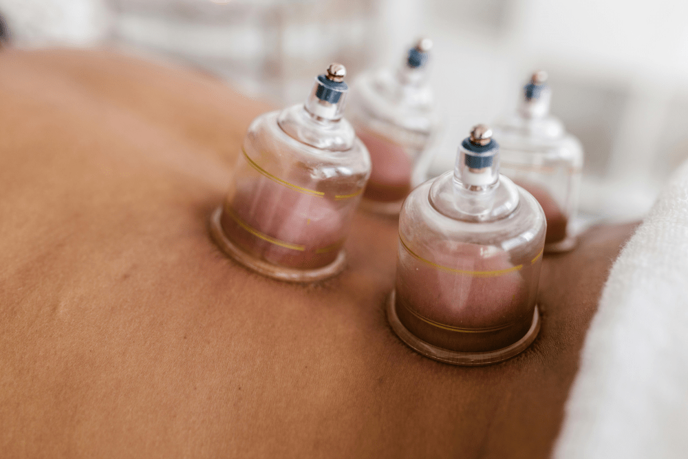 recovery cuppingtherapie